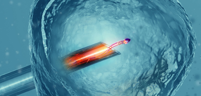 Illustration representing embryo transfer