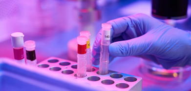 Laboratory sample vials used during egg retrieval