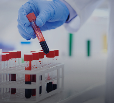 Hormonal blood tests for fertility at Abha Surgy Centre