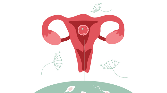 IUI fertility testing at Abha Surgy Centre