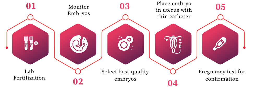 The five stages of IVF embryo transfer, from lab fertilisation to the confirmation pregnancy test